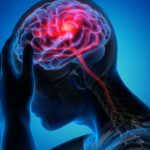 Comment l’ostéopathie peut soulager les migraines et les céphalées ?