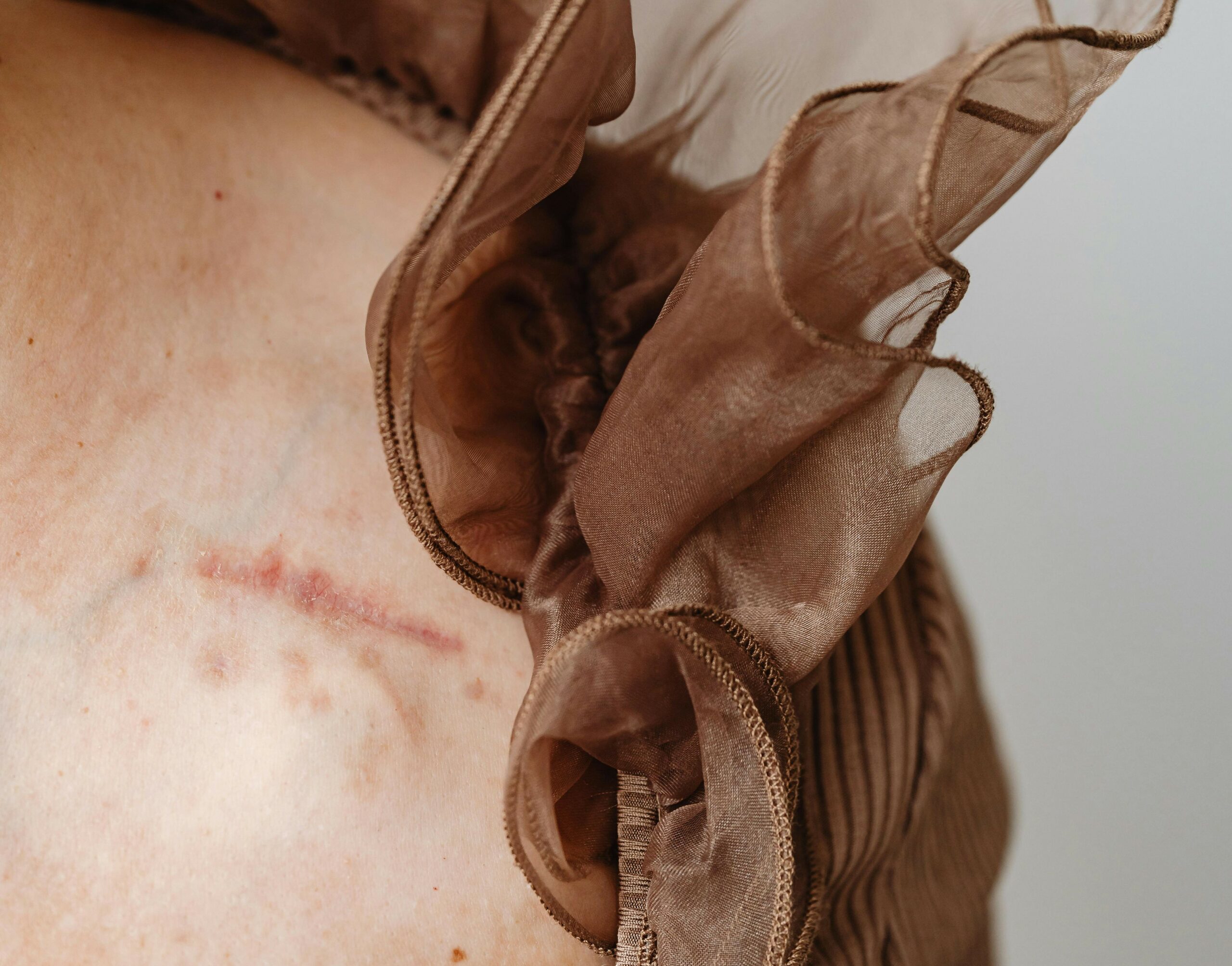Imafe d'une cicatrice sur la peau